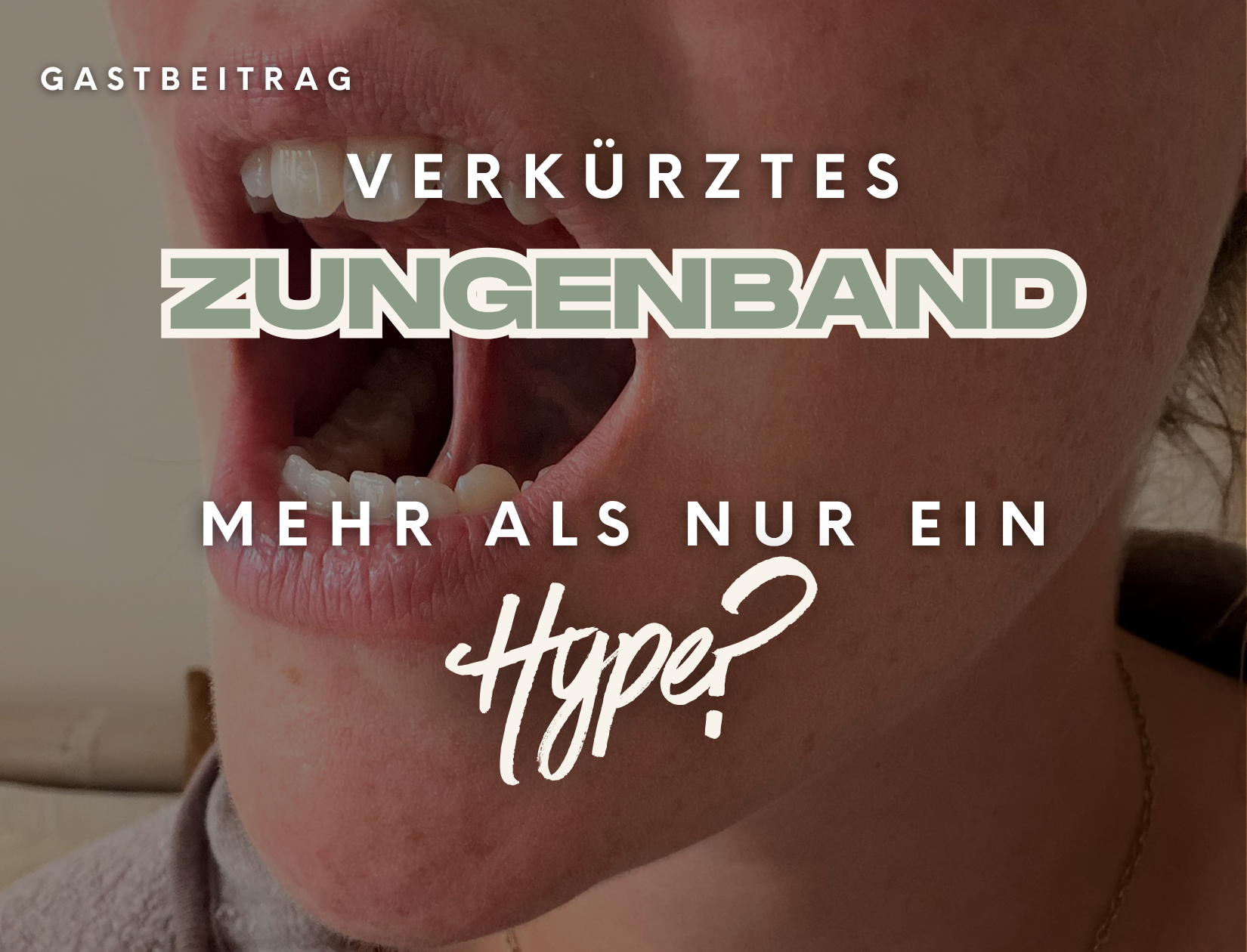 Gastbeitrag verkürztes Zungenband - mehr als nur ein Hype?! Auf dem Bild zu sehen ist ein geöffneter Mund mit einem verkürzten Zungenband